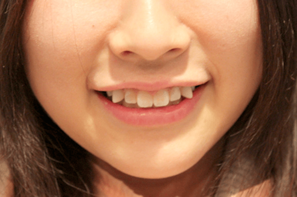 i denti nel mondo img0